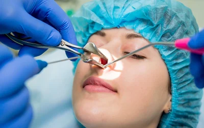 جراحی سینوزیت در چه شرایطی انجام میشود؟