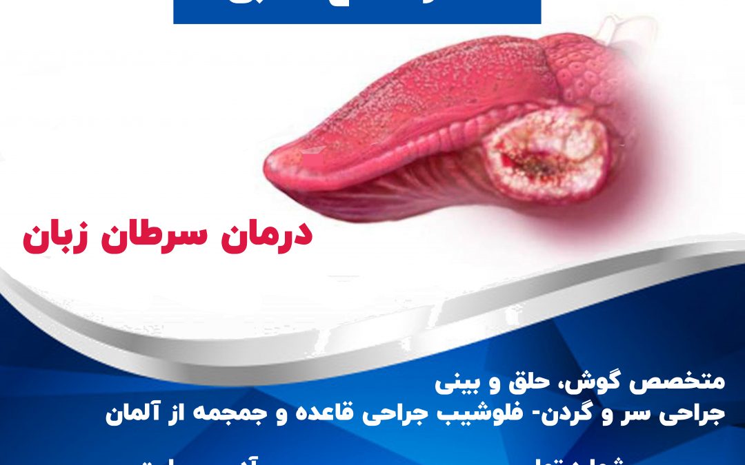 درمان سرطان زبان