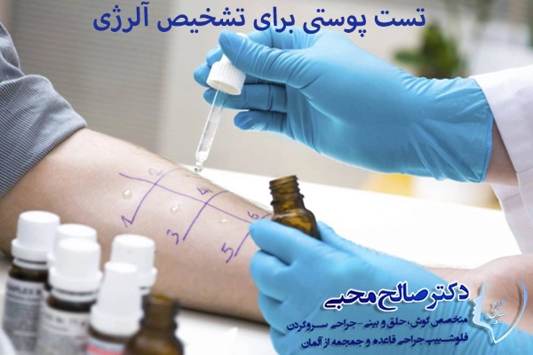 تست پوستی برای تشخیص آلرژی