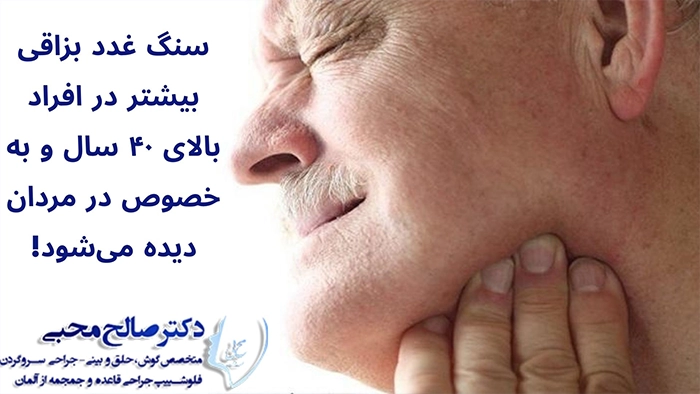 شیوع سنگ غدد بزاقی